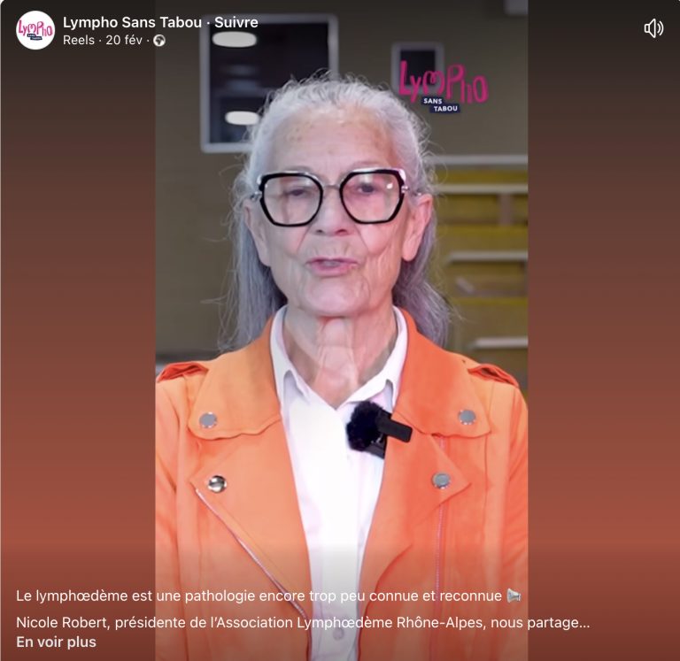 Capture écran de la vidéo de Nicole Robert, présidente de l'association lymphoedeme Rhône-alpes, pour illustrer la vidéo en question intégrée à cet article d'Actualité HDV cancer.